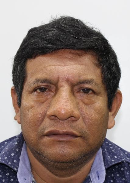 Walter Chirinos